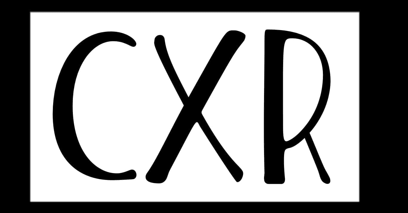 126. Investigations | Chest X Ray