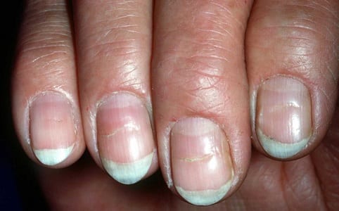 1.10 Beau has Beaus Lines