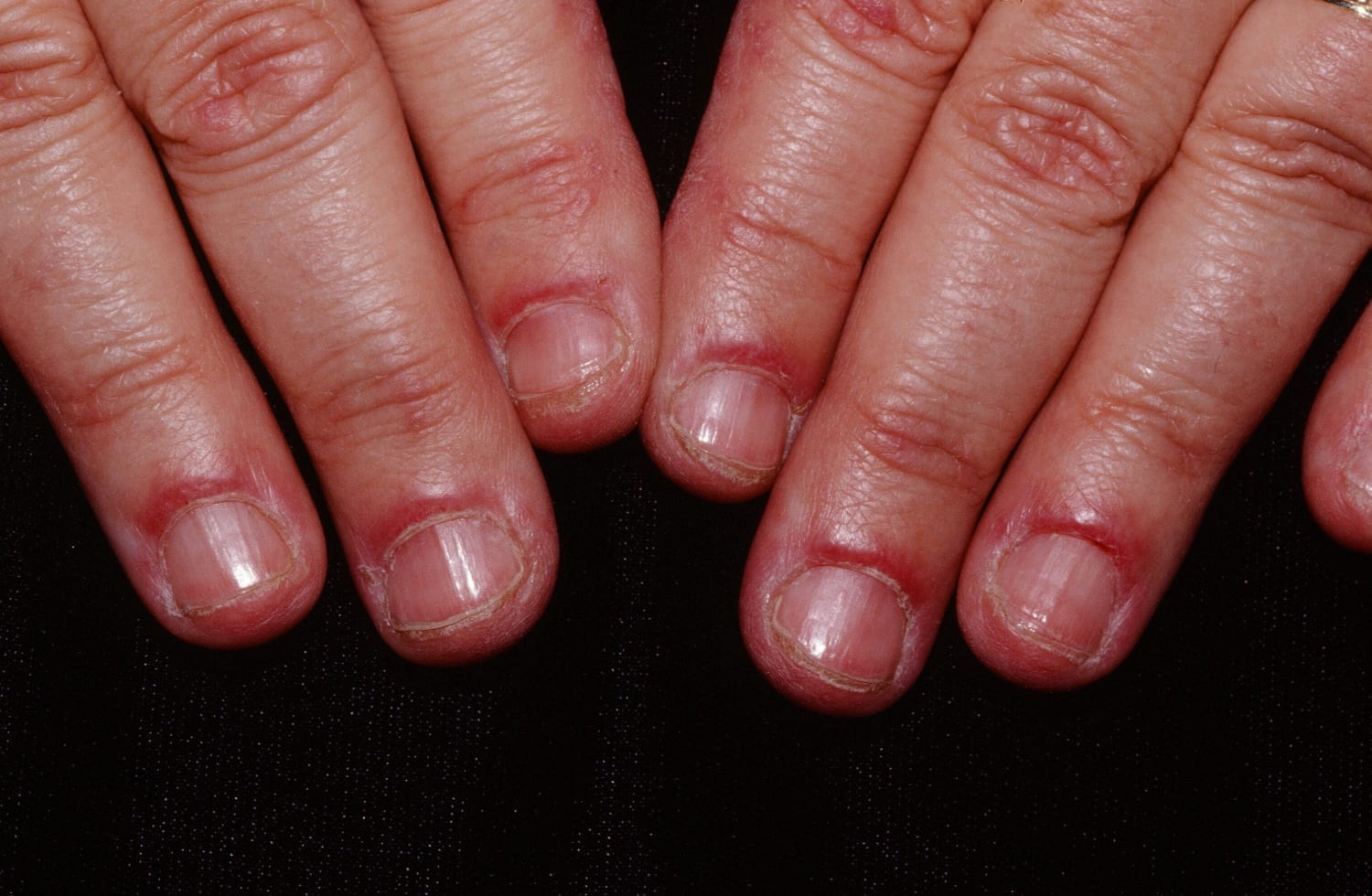 1.6 Lisa has Red Nails