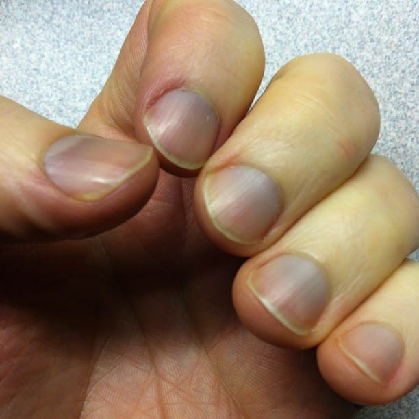 1.2 Rowland has Blue Nails