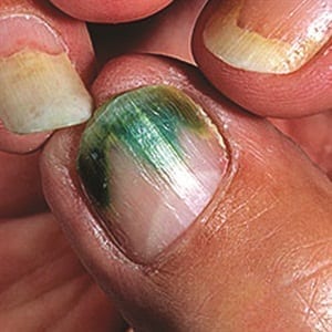 1.3 Lisa has Green Nails