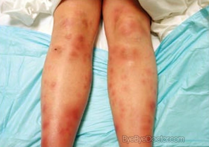 RACGP KFP 2016.1.6 – Julie has pain in the leg